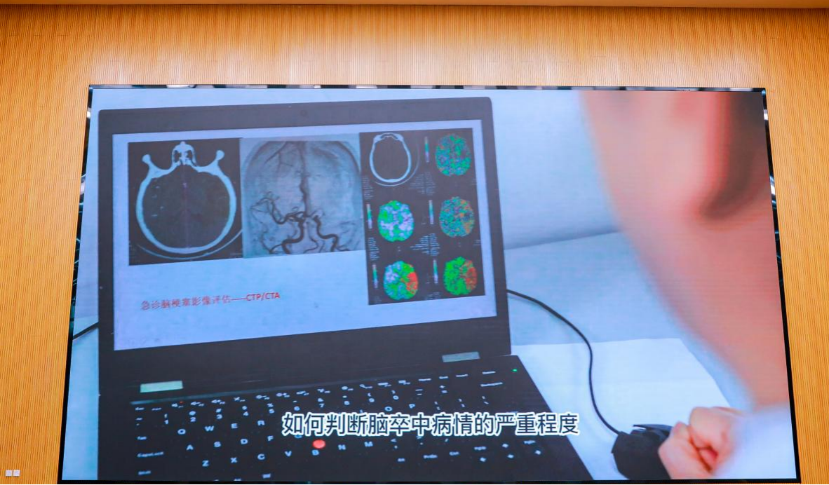 深圳市龙岗区人民医院：NIHSS 评分中文新译本发布会