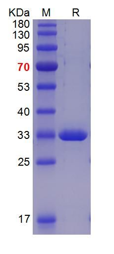 重组人S100-A8/A9蛋白复合物