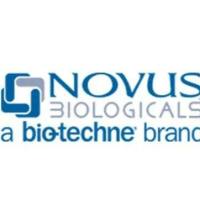 Rabbit Monoclonal MEF2A Antibody (JA33-04)