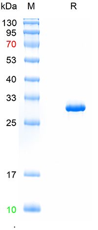 重组猪蓝耳病病毒GP5蛋白