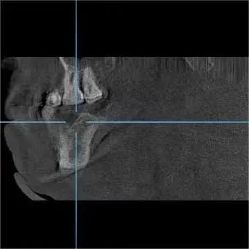 「黑科技」拉满看牙体验!拔牙、种牙『笑』着完成