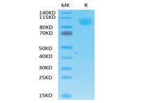 重组食蟹猴血管紧张素转换酶2蛋白