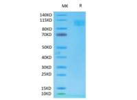 生物素标记重组食蟹猴血管紧张素转换酶2蛋白
