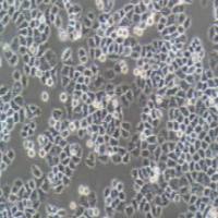 人卵巢上皮细胞