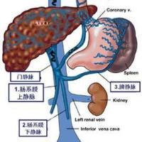 猪门静脉高压模型