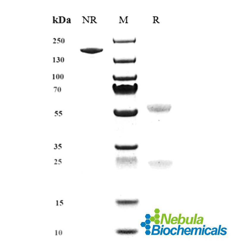 Human ERBB1 / EGFR / HER1 Antibody (Chinese Mil.Med.Sci. patent anti-EGFR, Research Use)