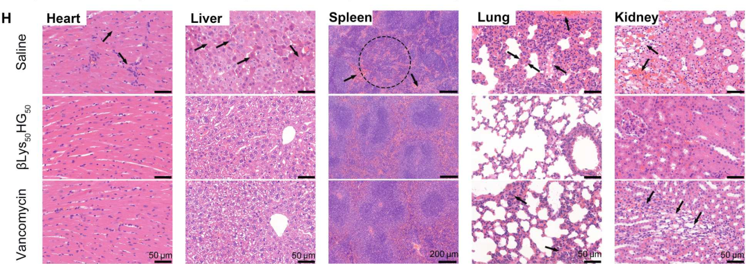 以机理导向的高效抗耐药菌多肽化合物设计和发现