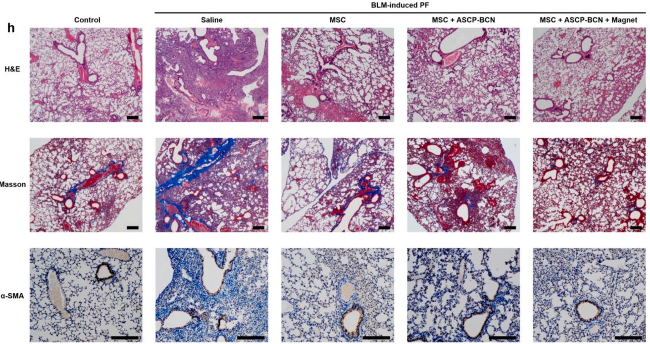 WBP 全身体积描记系统在肺纤维化研究中的应用