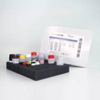 组胺ELISA试剂盒-任何食品或饮料样品Histamine ELISA kit Any food or beverage sample