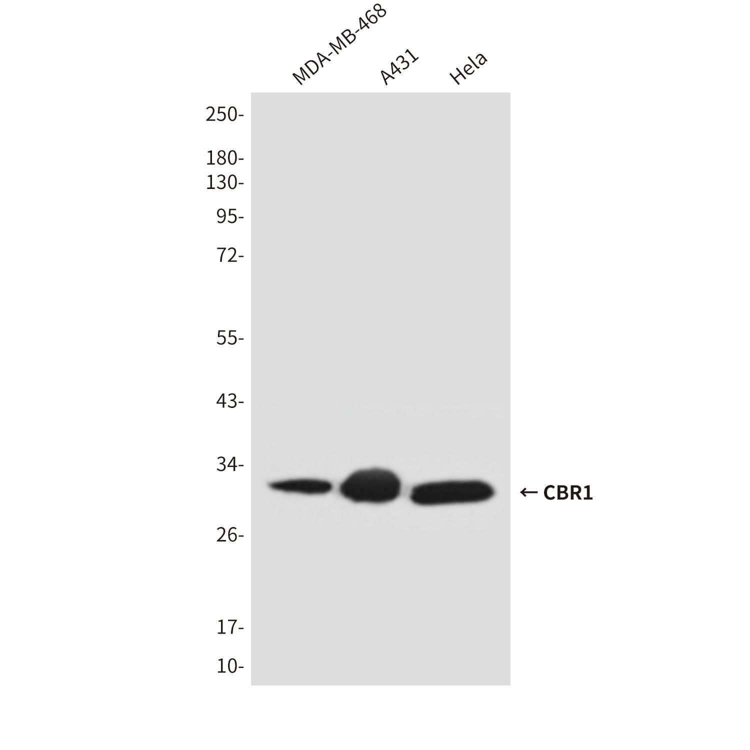 CBR1 (2C9) Mouse mAb