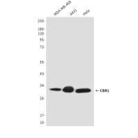 CBR1 (2C9) Mouse mAb
