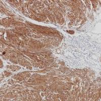 CD117 Recombinant Rabbit mAb