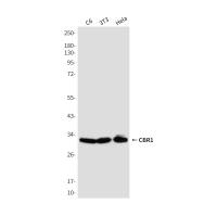 CBR1 Mouse mAb