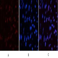 CD10 (7C7) Mouse mAb