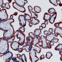 CD10 Recombinant Rabbit mAb