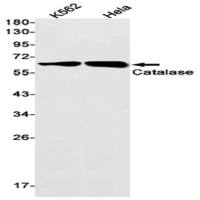 Catalase (DGR14771) Rabbit mAb