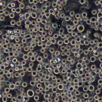 MEG-01人慢性粒细胞性白血病细胞