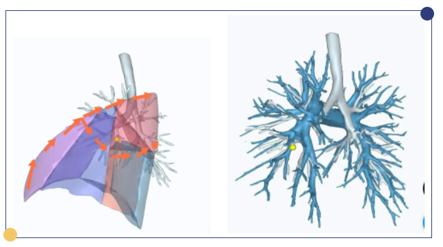 全程高能！面对这块罕见的肺，他独辟蹊径.....