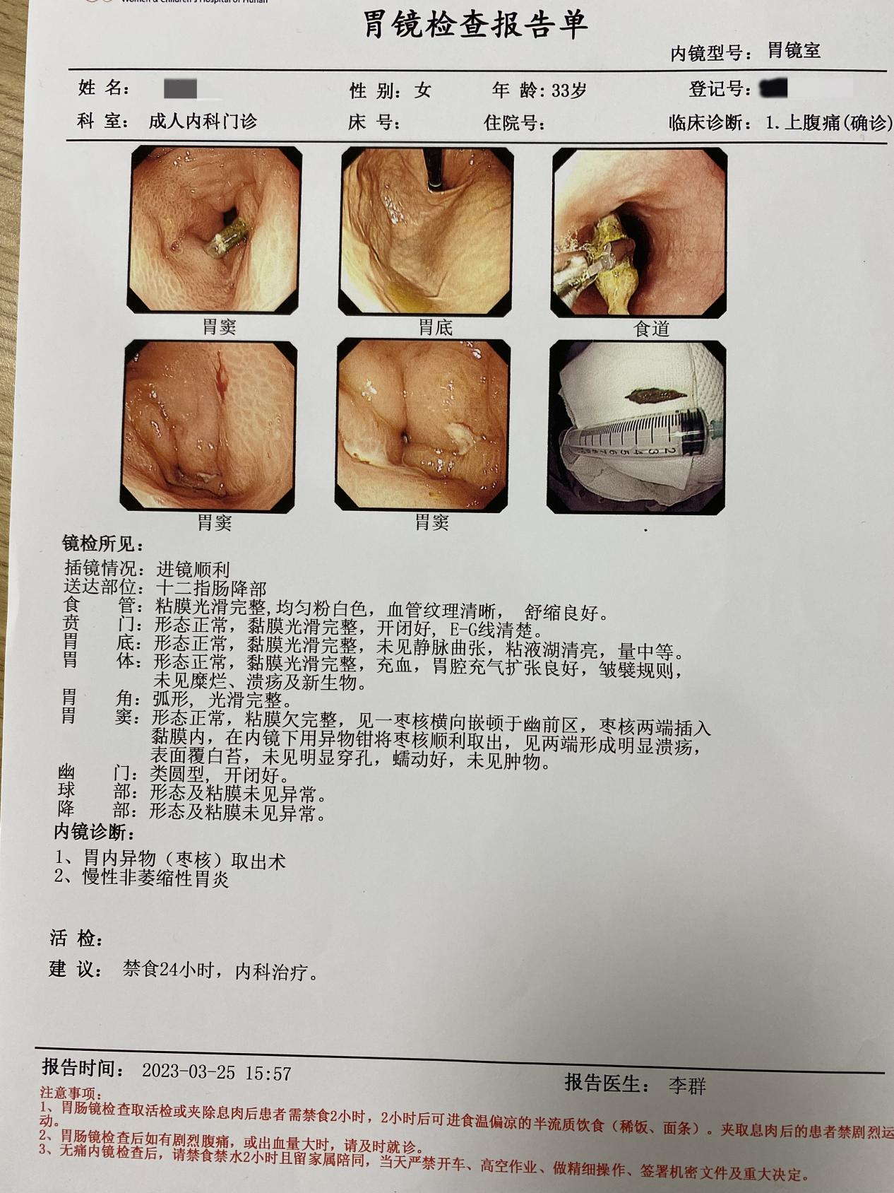 一颗枣核,差点给肚子穿个洞!干饭不当,小心没命!