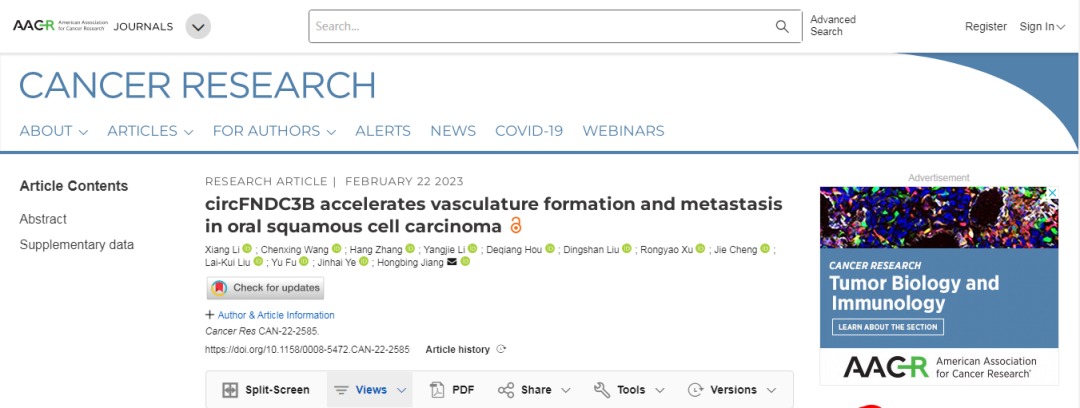 Cancer Research丨circFNDC3B加速OSCC血管形成和转移
