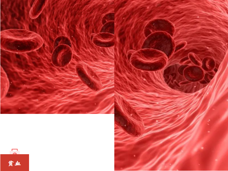 贫血补血，需对症下药！