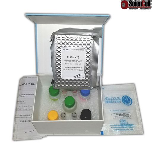 Human CD56/NCAM-1 ELISA Kit