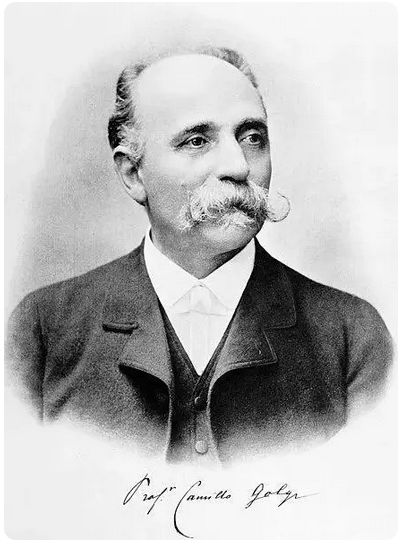 为什么高尔基染色法只能镀染百分之五的神经元，还被认为是很神奇的结果？