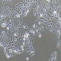 人肾细胞腺癌细胞，ACHN（带STR鉴定）