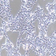 人胚肾细胞，293T（带STR鉴定）