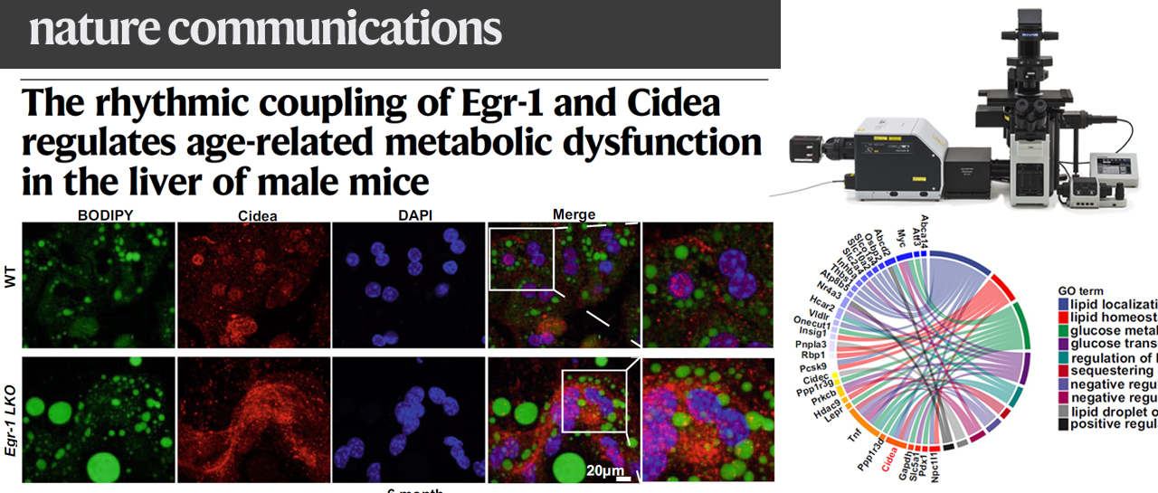 科技前沿 | SpinSR助力揭示肝脏中与年龄相关的代谢功能障碍的调控新机制