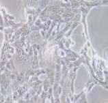 人胰腺癌细胞，CFPAC-1（带STR鉴定）