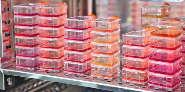 人胃癌细胞,SNU-216