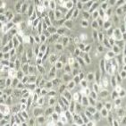 人膀胱癌细胞，5637（带STR鉴定）