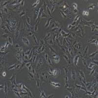 人肺癌细胞,A549(带STR鉴定)