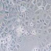 NCM460人正常结肠上皮细胞(带STR鉴定)