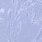 人正常结肠上皮细胞，CCD841 CoN（带STR鉴定）