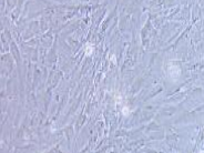 人肝癌细胞，SNU-387（带STR鉴定）