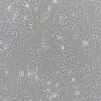 人横纹肌瘤细胞,A-673(带STR鉴定)