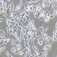 人甲状腺癌细胞，TT（带STR鉴定）