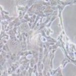 人胰腺癌细胞，CFPAC-1（带STR鉴定）