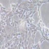 人胰腺癌细胞,CFPAC-1(带STR鉴定)