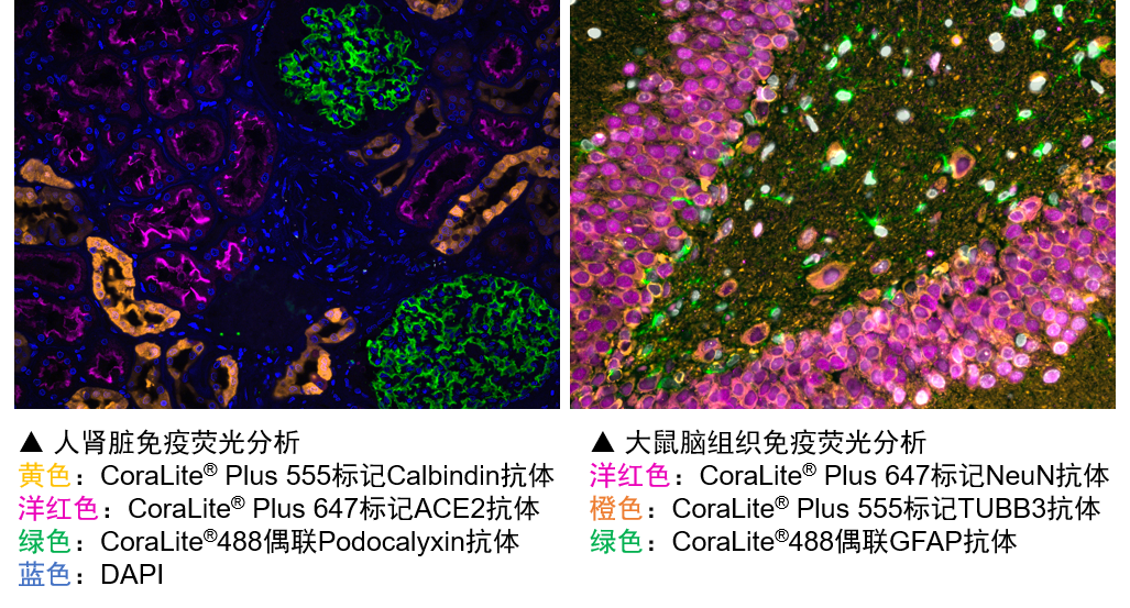完美的荧光成像，离不开这个关键点！