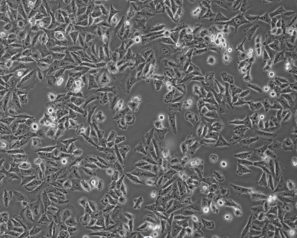 细胞攻略 | A-375(人恶性黑色素瘤细胞)细胞培养教程
