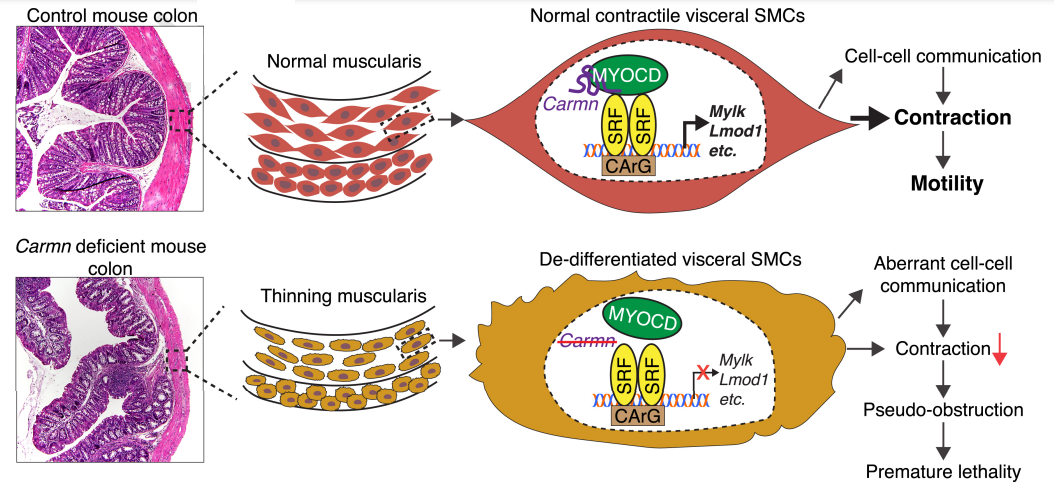 lncRNA研究进展盘点丨20230414期