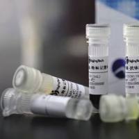 精氨酸酶(ARG)单克隆抗体(生物素标记)