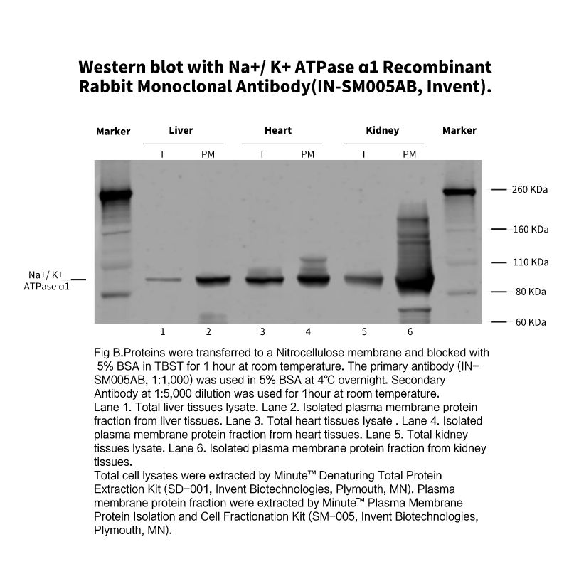 IN-SM005AB Invent ® Na+/ K+ ATPase ɑ1 重组兔单克隆抗体