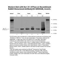 IN-SM005AB Invent ® Na+/ K+ ATPase ɑ1 重组兔单克隆抗体