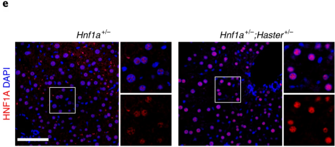 Nat Cell Biol：糖尿病疗法新靶点！（2）