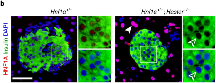 Nat Cell Biol：糖尿病疗法新靶点！（2）