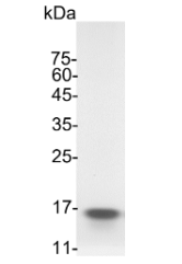 Croyez Bioscience丨艾美捷GMP GM-CSF，人方案